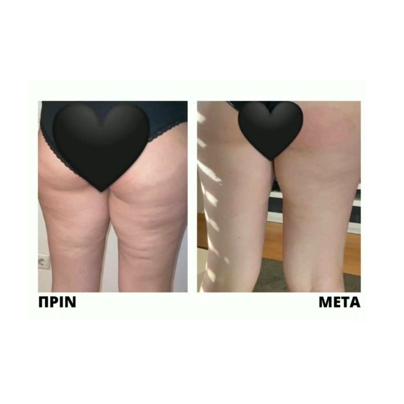 anti-cellulite1-products-1300X1300